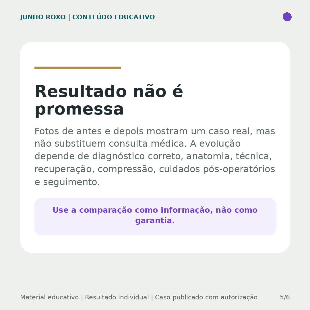 Resultado não é promessa