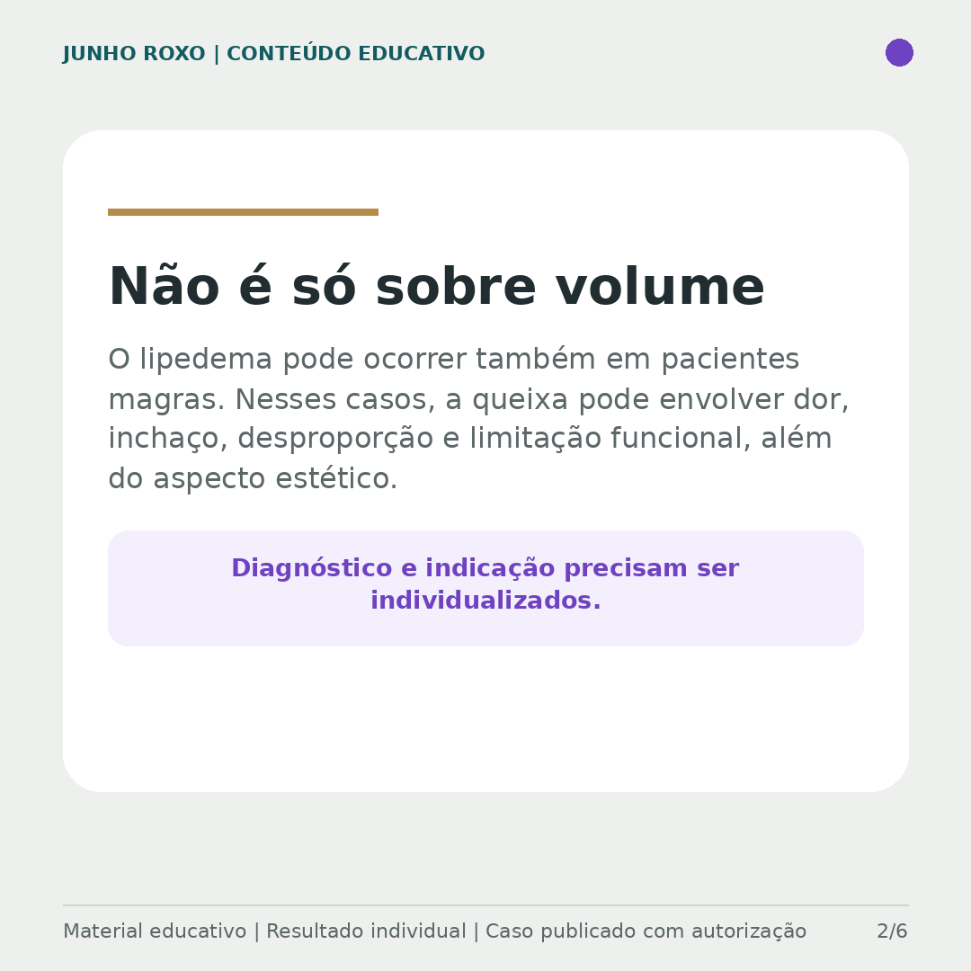 Não é só sobre volume