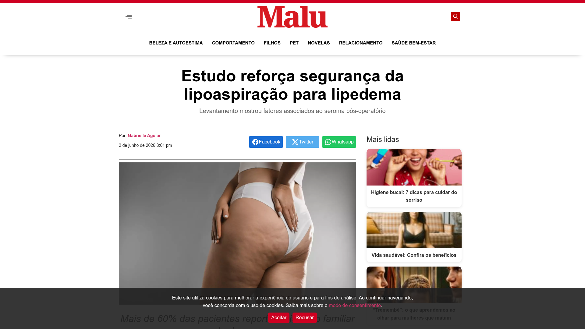 Print da matéria 'Estudo reforça segurança da lipoaspiração para lipedema' publicada na Revista Malu
