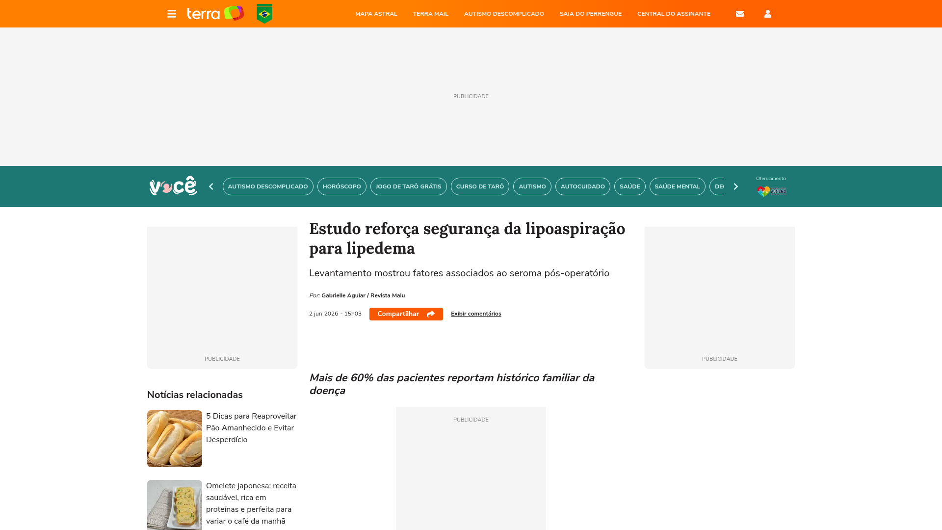 Print da matéria 'Estudo reforça segurança da lipoaspiração para lipedema' publicada no portal Terra